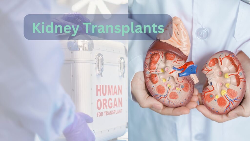 Kidney Transplants What to Expect Before, During, and After Surgery by Famous Urologist Dr. Sumit Bansal in Delhi NCR