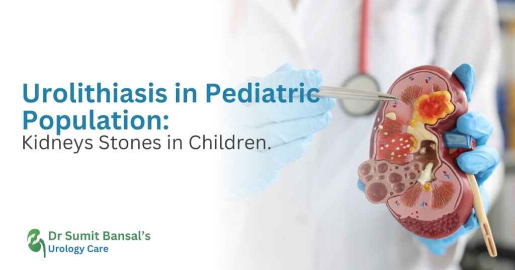 Urolithiasis in Pediatric Population: Kidney Stones in Children