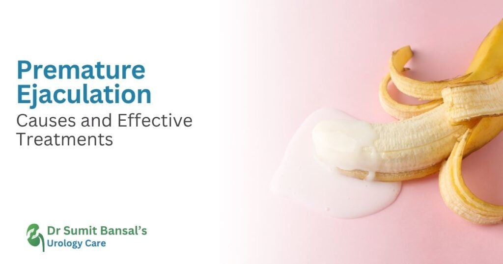 Premature Ejaculation Causes and Effective Treatments