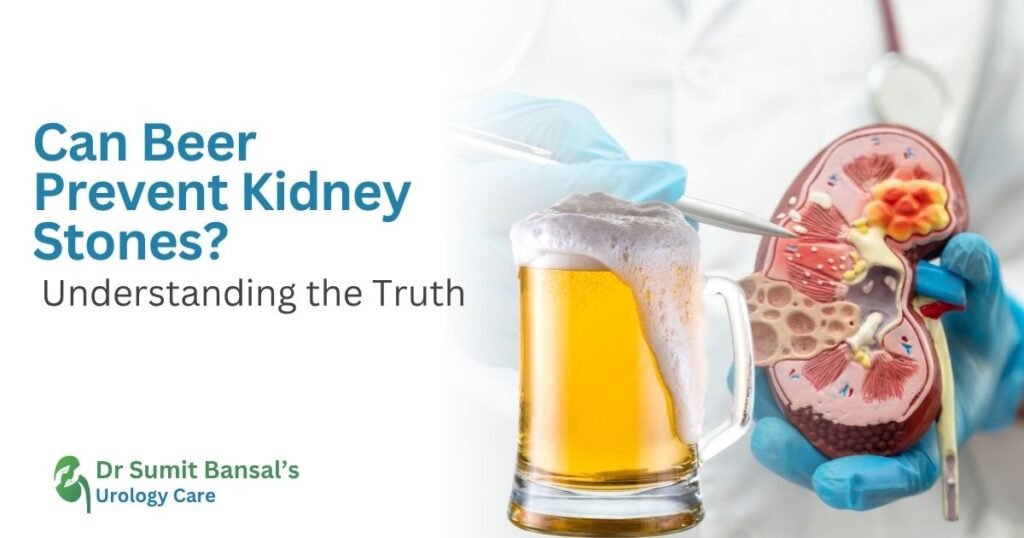 Can Beer Prevent Kidney Stones Understanding the Truth