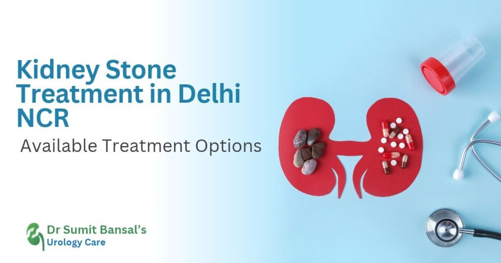 Kidney Stone Treatment in Delhi NCR_ Available Treatment Options
